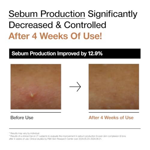 ANUA Rice 70 Glow Milky Toner 8.45 fl oz (250ml) - Hydrating and Brightening Face Toner with Rice Water, Niacinamide, Ceramides, Panthenol, Fragrance-Free, Non-Comedogenic, Suitable for All Skin Types, Korean Skincare