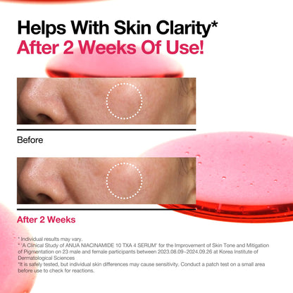 ANUA Niacinamide 10 + TXA 4 Serum, Hyaluronic Acid, Tranexamic acid, Vitamin B12, Facial Serum for Glass Skin, Clarifying, Radiant Complexion with Natural Color, Korean Skin Care (30ml /1.01 fl.oz)