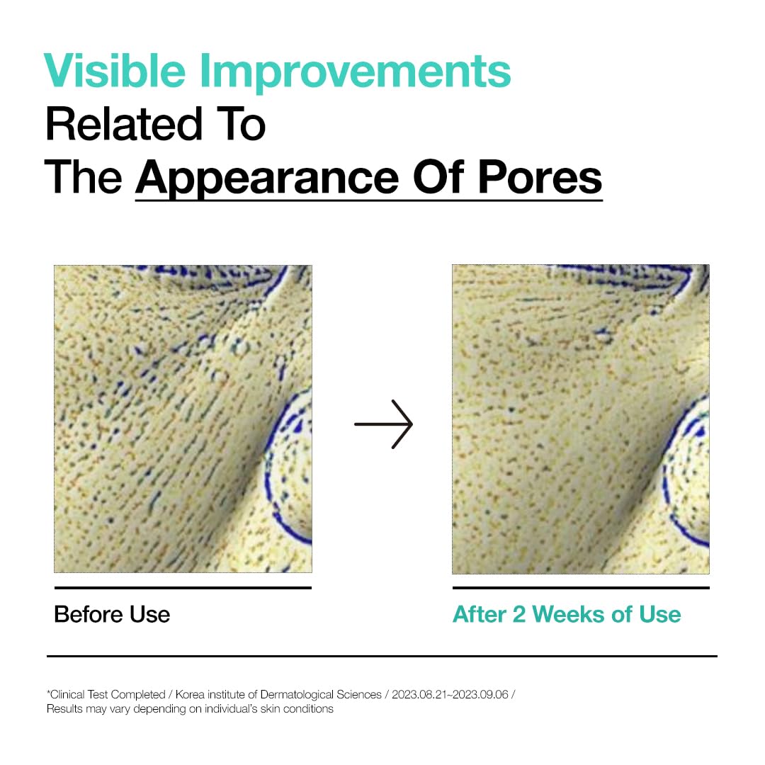 Anua BHA 2% Gentle Exfoliating Toner 150ml