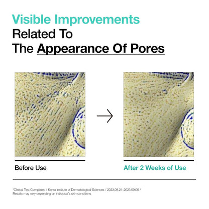 Anua BHA 2% Gentle Exfoliating Toner 150ml