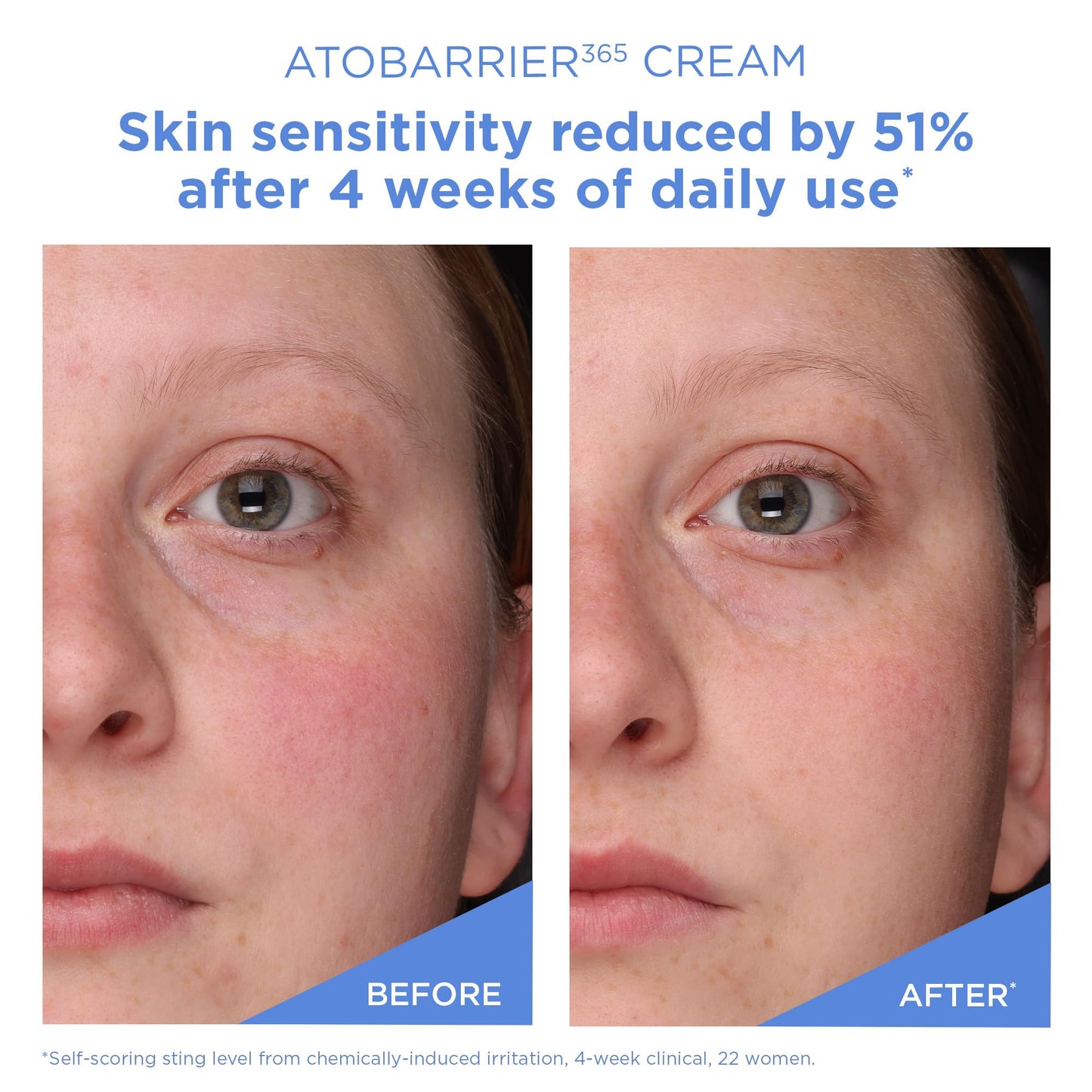 AESTURA ATOBARRIER365 Cream with Ceramide, Korean Moisturizer for Barrier Repair | 120-hour Lasting Hydration, Capsuled Ceramides for Dry & Sensitive Skin, Non-comedogenic tested, 2.70 fl.oz.(Renewed)